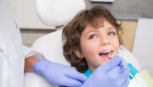 Wygląd mleczaków po lapisowaniu to problem wyłącznie estetyczny. Korzyści jest więcej