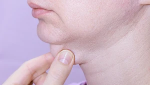 Masz dość "drugiego podbródka"? Tak pozbędziesz się go bez skalpela i drogich zabiegów 