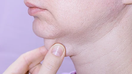 Jak pozbyć się problemu drugiego podbródka?