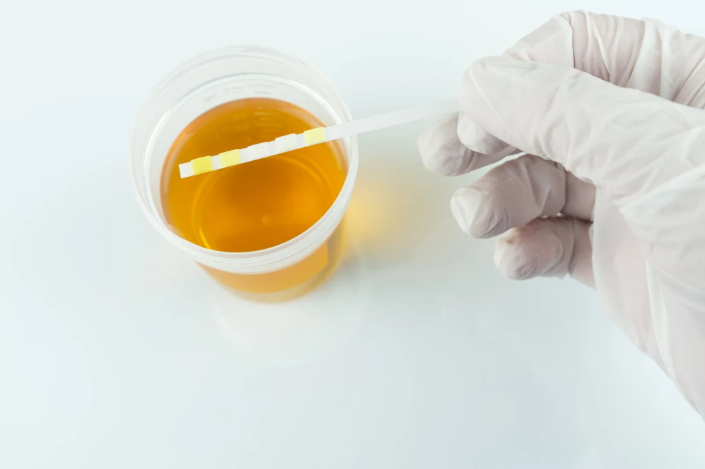 Na badanie moczu wpływa wiele czynników, dlatego należy się do niego odpowiednio przygotować Na badanie moczu wpływa wiele czynników, dlatego należy się do niego odpowiednio przygotować