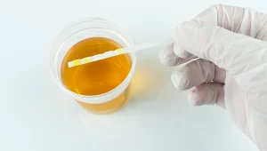 Na badanie moczu wpływa wiele czynników, dlatego należy się do niego odpowiednio przygotować