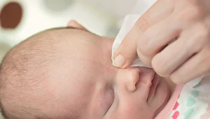 Zapalenie spojówek u najmłodszych dzieci to dość powszechne zjawisko związane z anatomią oka