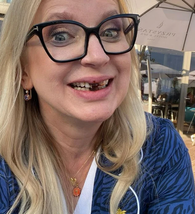 Marzena Rogalska opublikowała swoje "brzydkie" zdjęcie./ Fotografia pochodzi z https://www.instagram.com/marzena_rogalska/ Marzena Rogalska opublikowała swoje "brzydkie" zdjęcie./ Fotografia pochodzi z https://www.instagram.com/marzena_rogalska/