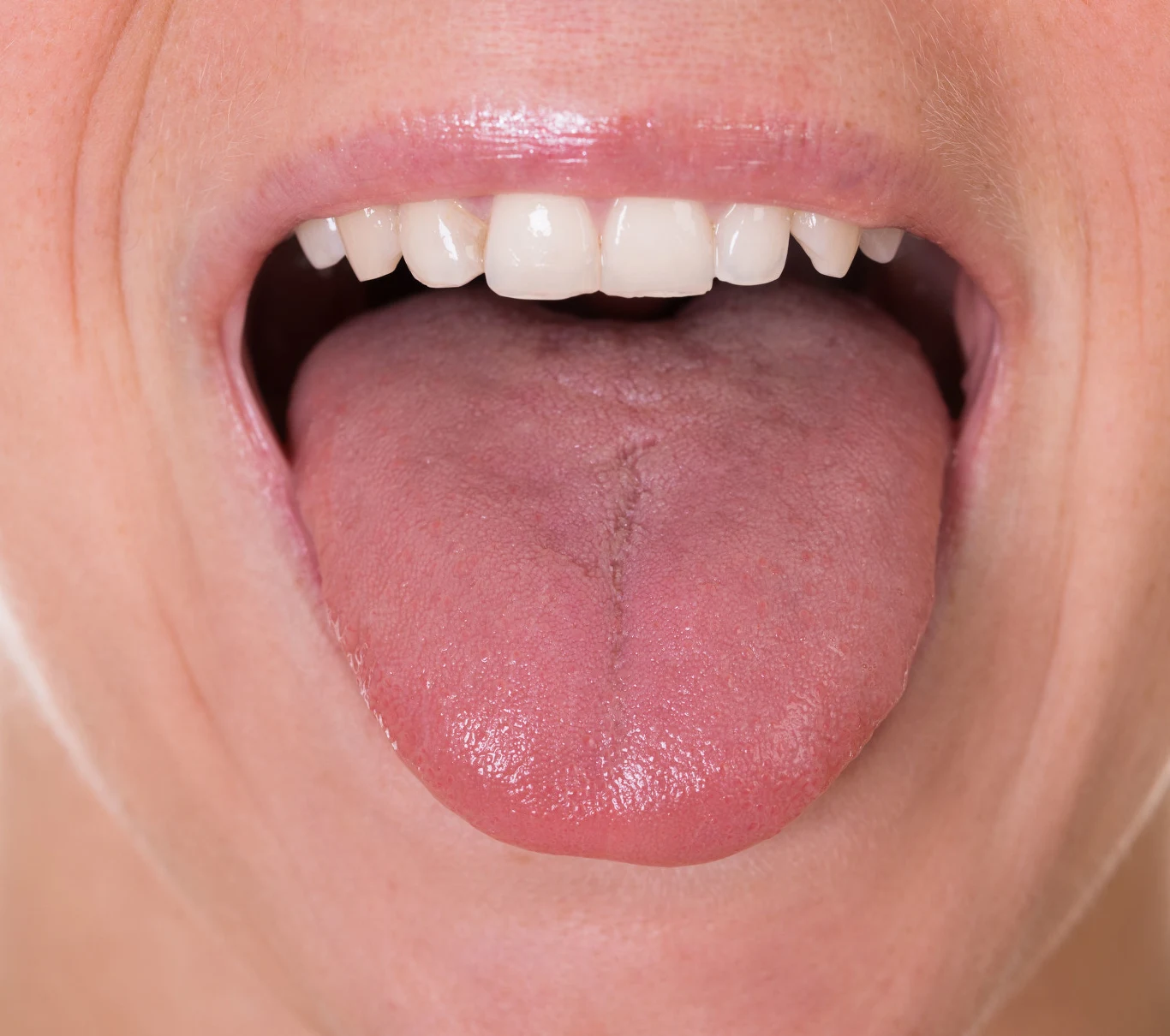 Higiena języka to ważny element dbałości o zdrowie i świeży oddech