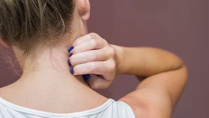 Pojedyncze epizody świądu nie są niczym niezwykłym, ale jeśli pojawiają się często - trzeba reagować