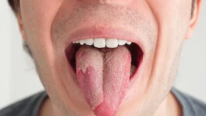 Przyjrzyj się uważnie swojemu językowi