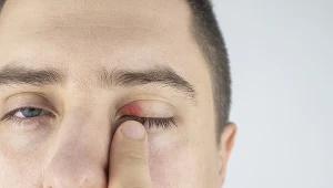 Gradówka często bywa mylona z jęczmieniem; sprawdź, po czym ją poznać