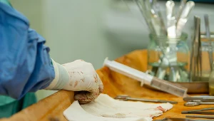 Trepanację czaszki wykonuje się najczęściej w celu usunięcia krwiaka wewnątrzczaszkowego