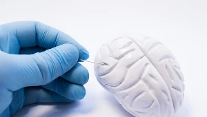 Oponiak to guz mózgu