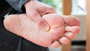 Modzele powstają z wiekiem jako  skutek noszenia butów na obcasie i... nadwagi