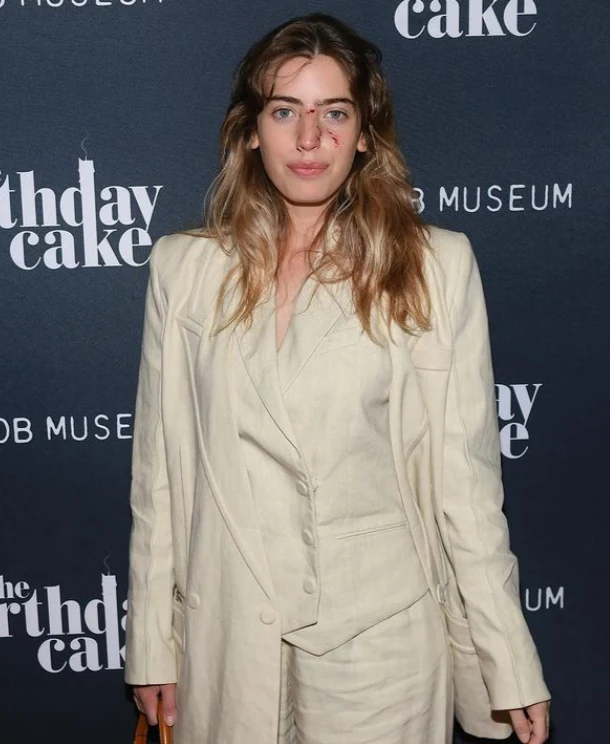 Clara McGregor przyszła na premierę z ranami po pogryzieniu psa, https://www.instagram.com/claramcgregor/ Clara McGregor przyszła na premierę z ranami po pogryzieniu psa, https://www.instagram.com/claramcgregor/