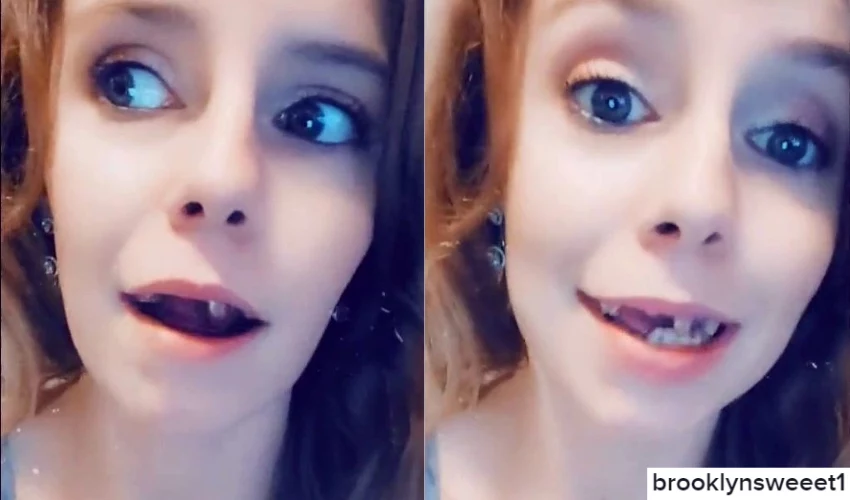 Brooke Johnson ma tak słabe szkliwo, że zęby dosłownie się kruszą