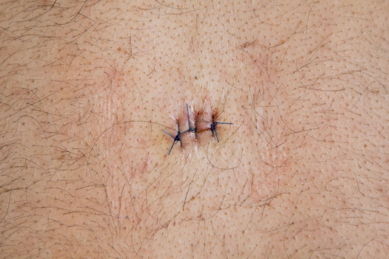 Dzięki "Pryszczylli" dermatologia stała się bardzo medialnym tematem Dzięki "Pryszczylli" dermatologia stała się bardzo medialnym tematem