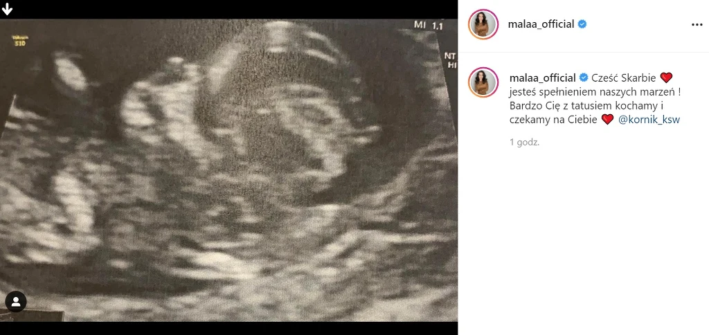 "Mała" Ania z "Warsaw Shore" spodziewa się dziecka /https://www.instagram.com/malaa_official/ "Mała" Ania z "Warsaw Shore" spodziewa się dziecka /https://www.instagram.com/malaa_official/