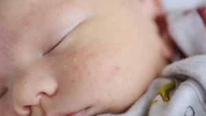 Zmiany mogą niepokoić młodych rodziców, ale w tym przypadku nie ma powodu do obaw