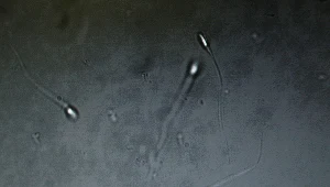 Plemniki pod mikroskopem; zdj. iilustracyjne