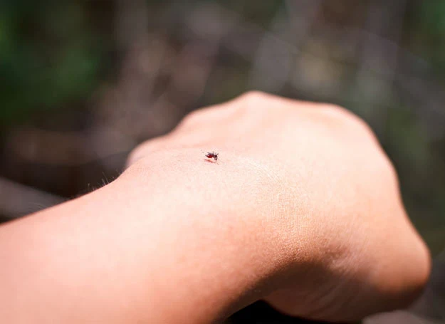 Ugryzienie przez meszki zwykle kończy się na bólu, ale w rzadkich przypadkach konieczna jest interwencja lekarza Ugryzienie przez meszki zwykle kończy się na bólu, ale w rzadkich przypadkach konieczna jest interwencja lekarza