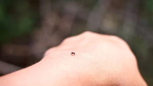 Ugryzienie przez meszki zwykle kończy się na bólu, ale w rzadkich przypadkach konieczna jest interwencja lekarza