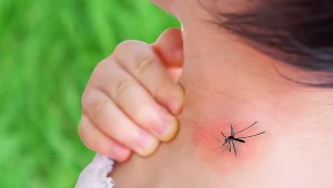 Walka z malarią to przede wszystkim unieszkodliwianie owadów, które ją przenoszą