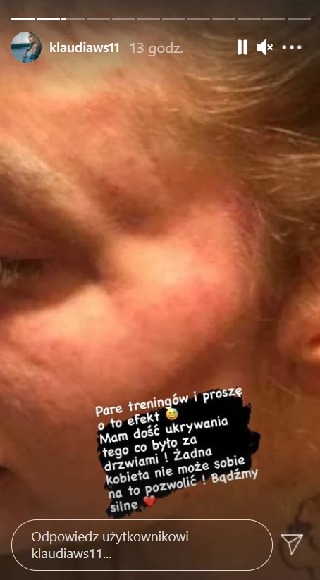 Klaudia podzieliła się wstrząsającymi zdjęciami /https://www.instagram.com/klaudiaws11 Klaudia podzieliła się wstrząsającymi zdjęciami /https://www.instagram.com/klaudiaws11