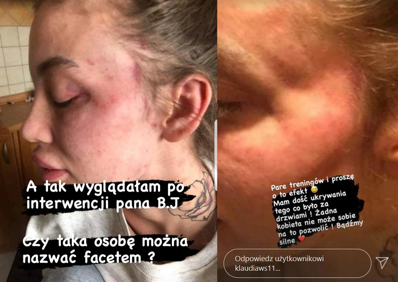 Klaudia Stec ofiarą przemocy? /https://www.instagram.com/klaudiaws11/ Klaudia Stec ofiarą przemocy? /https://www.instagram.com/klaudiaws11/