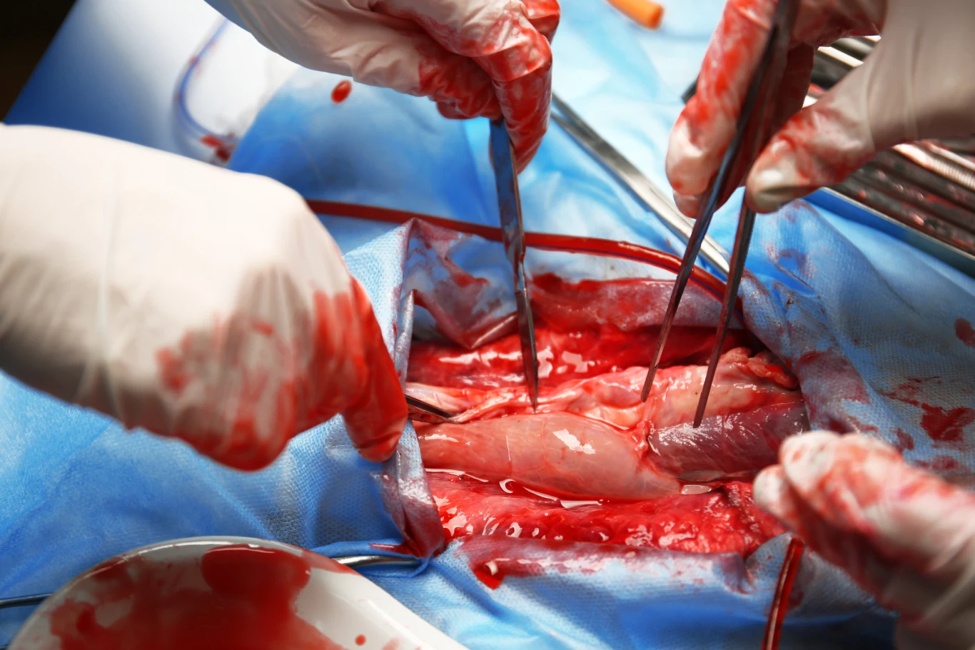 Klasyczne operacje serca są obarczone ogromny ryzykiem i nie do zrobienia w warunkach polowych (zdj. ilustracyjne) Serce to jeden z najważniejszych organów naszego ciała - trudno go zastąpić