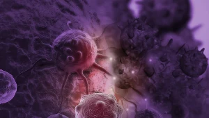 Naukowcy znaleźli wspólną cechę wszystkich nowotworów