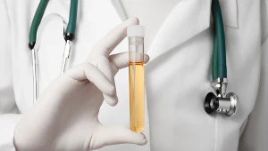 Przyczyny obecności białka w moczu mogą być związane z chorobami nerek lub przyjmowaniem niektórych leków