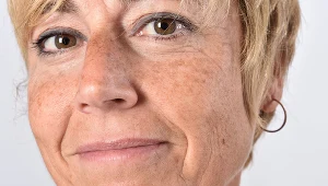 Bardzo trudno jest zniwelować ślady po wieloletnim opalaniu się