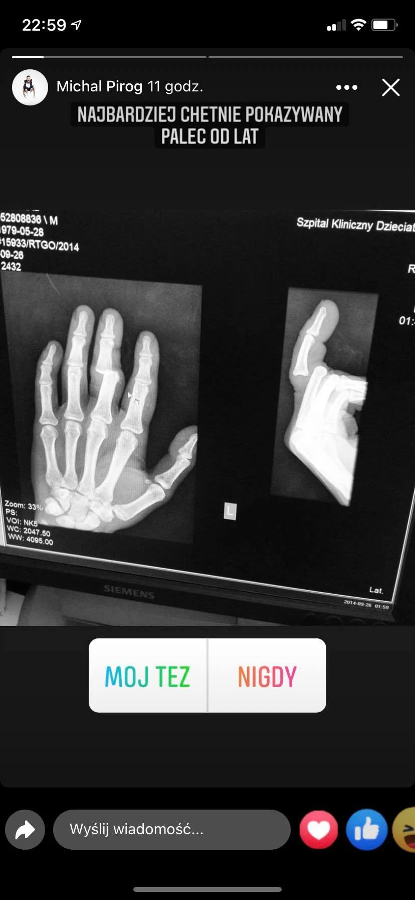 Michał Piróg w szpitalu, fot. https://www.instagram.com/michalpirog/ Michał Piróg w szpitalu, fot. https://www.instagram.com/michalpirog/