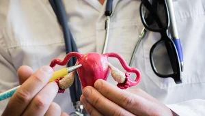 Mięśniaki macicy objawiają się bólem, dyskomfortem, zaburzeniami miesiączkowania lub problemami z zajściem w ciążę