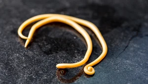 Objawy zakażenia można długo bagatelizować z uwagi na ich niespecyficzność