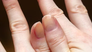 Sprawdzone sposoby na rozdwajające się paznokcie