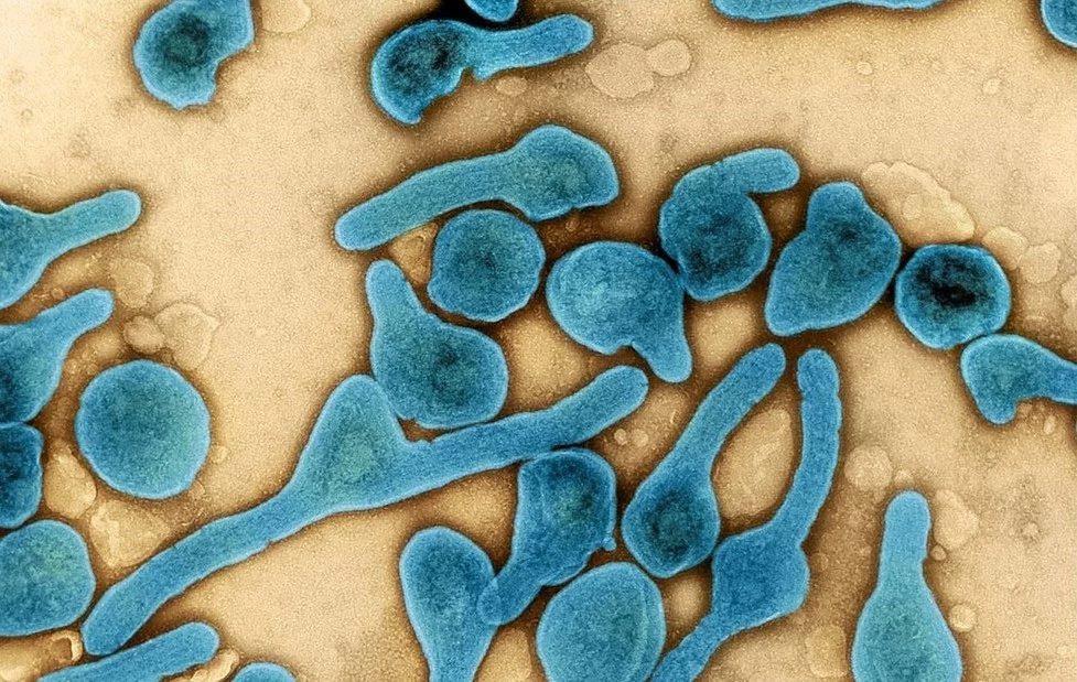 Wirus Marburga pod mikroskopem