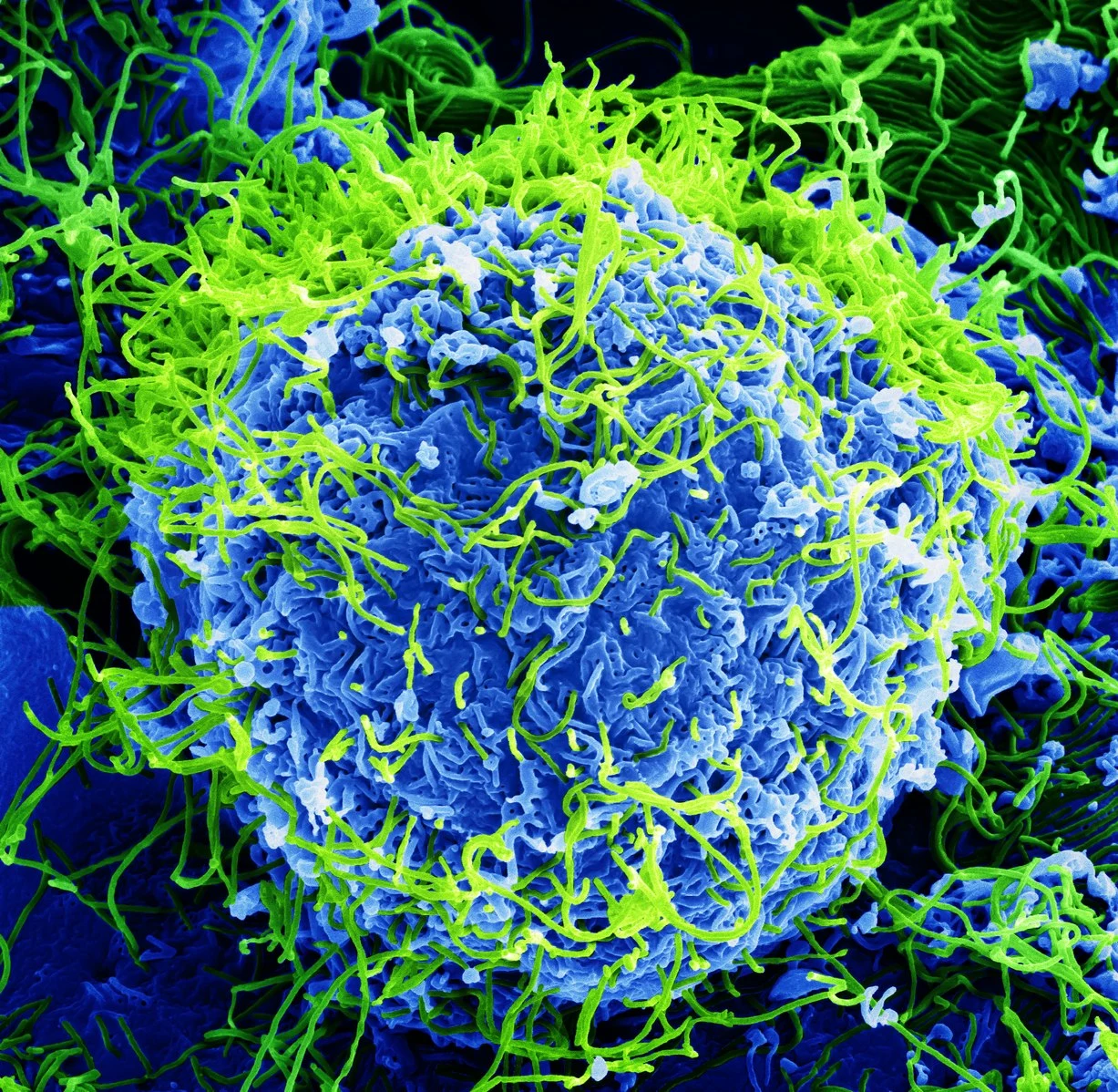 Wirus ebola Wirus ebola