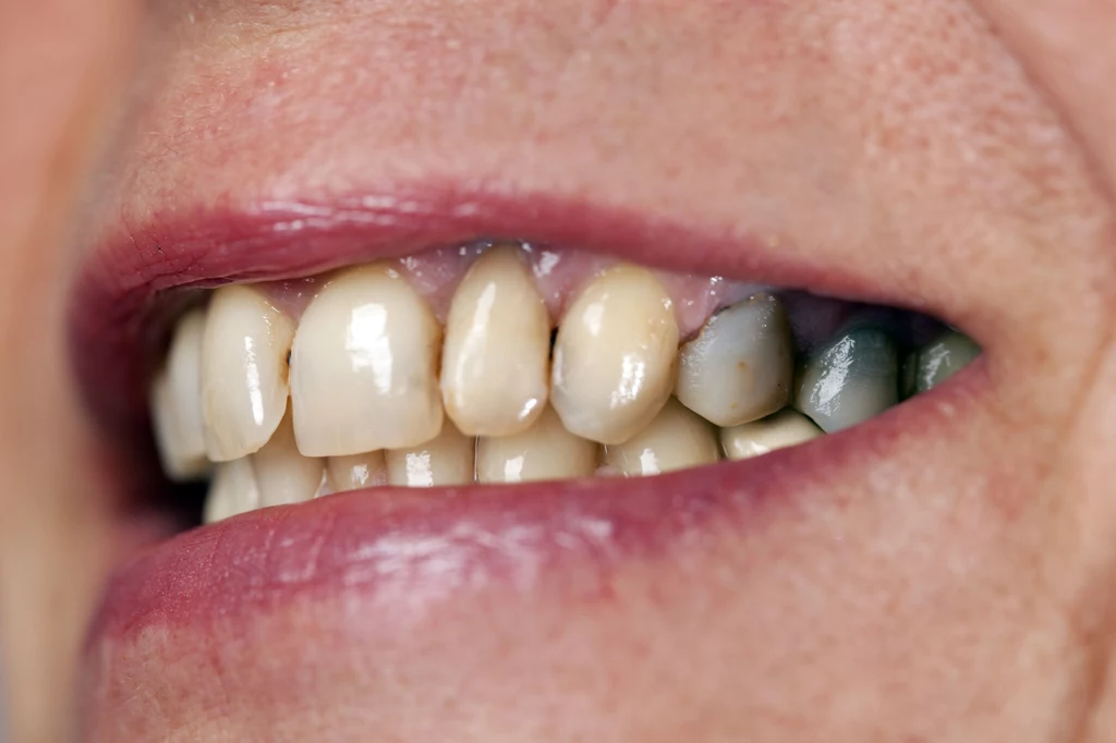 Kiedy chorują zęby, obciążony jest cały organizm