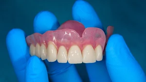 Seniorzy zrobią to u dentysty za darmo. Wiele osób o tym nie wie