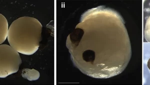 Przełom w medycynie - organoidy mózgowe wykształciły struktury oka