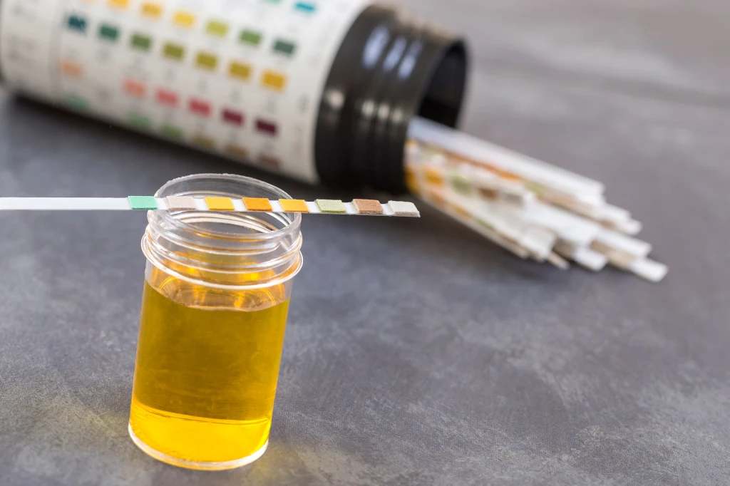 Niewiele jest badań tak prostych, bezbolesnych i niekłopotliwychm