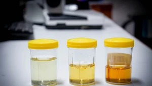 Niektóre nieprawidłowości widać gołym okiem