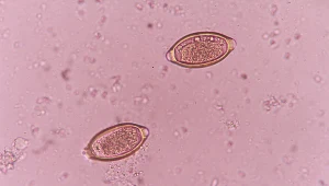 Jajeczka z larwami włosogłówki mogą znajdować się na produktach spożywczych