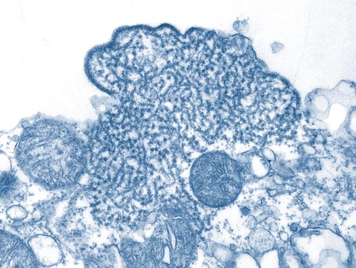 Wirus Nipah widziany pod mikroskopem