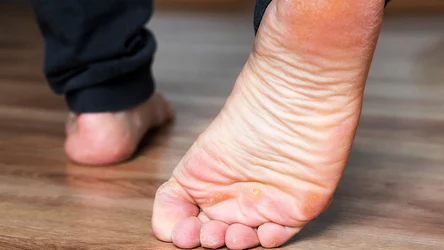 Odciski na stopach są bardzo bolesne i często utrudniają swobodne poruszanie się