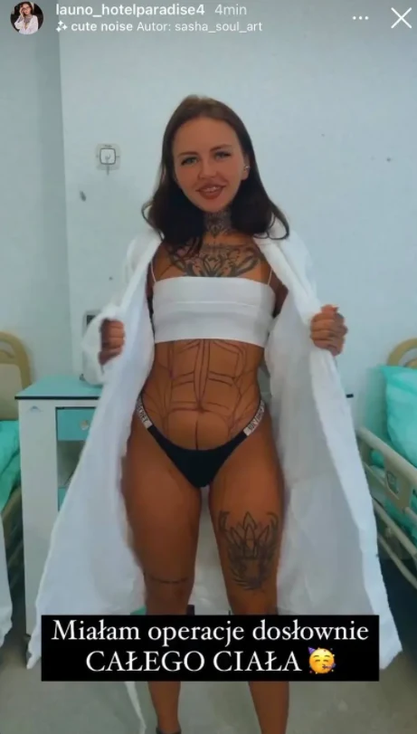 Klaudia z "Hotelu Paradise" przeszła operację! Foto: Instagram / @launo_hotelparadise4