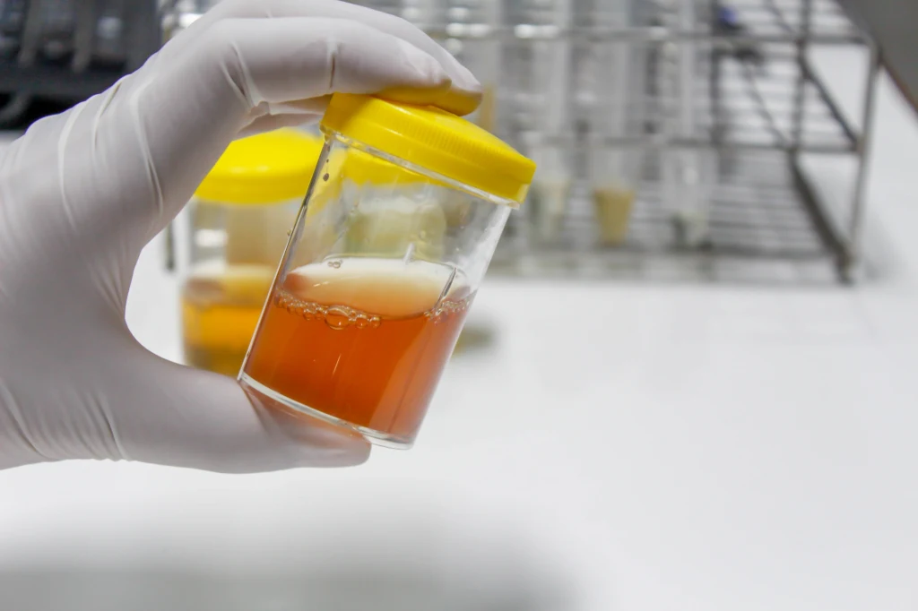 Zazwyczaj poranny mocz ma intensywniejszy kolor i zapach