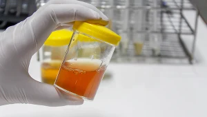 Zazwyczaj poranny mocz ma intensywniejszy kolor i zapach