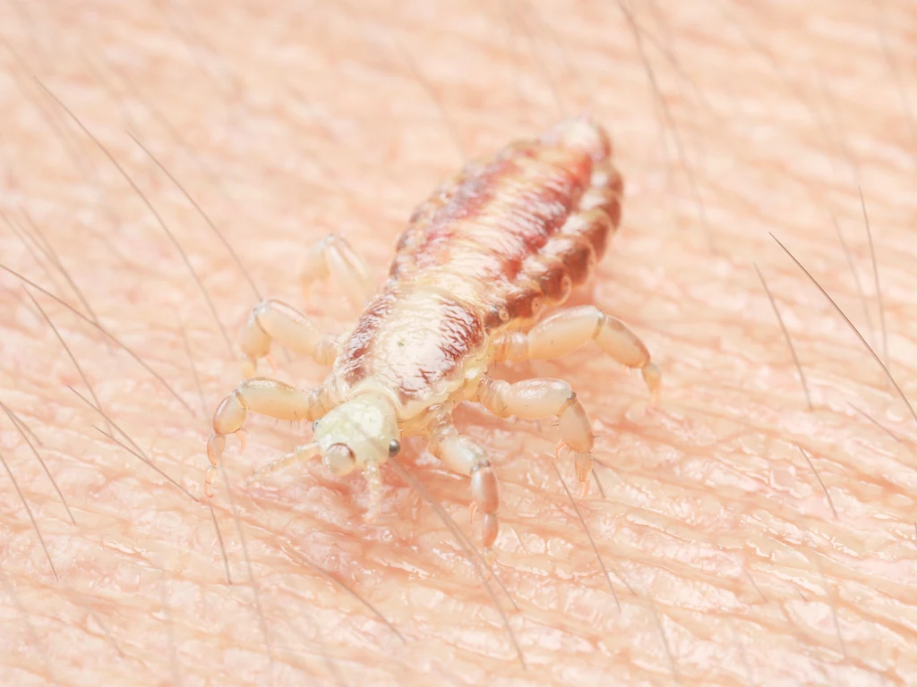 Wszy mogą "przeskoczyć" na każdego, nie należy więc ich łączyć z zaniedbaniem i brakiem higieny Wszy mogą "przeskoczyć" na każdego, nie należy więc ich łączyć z zaniedbaniem i brakiem higieny