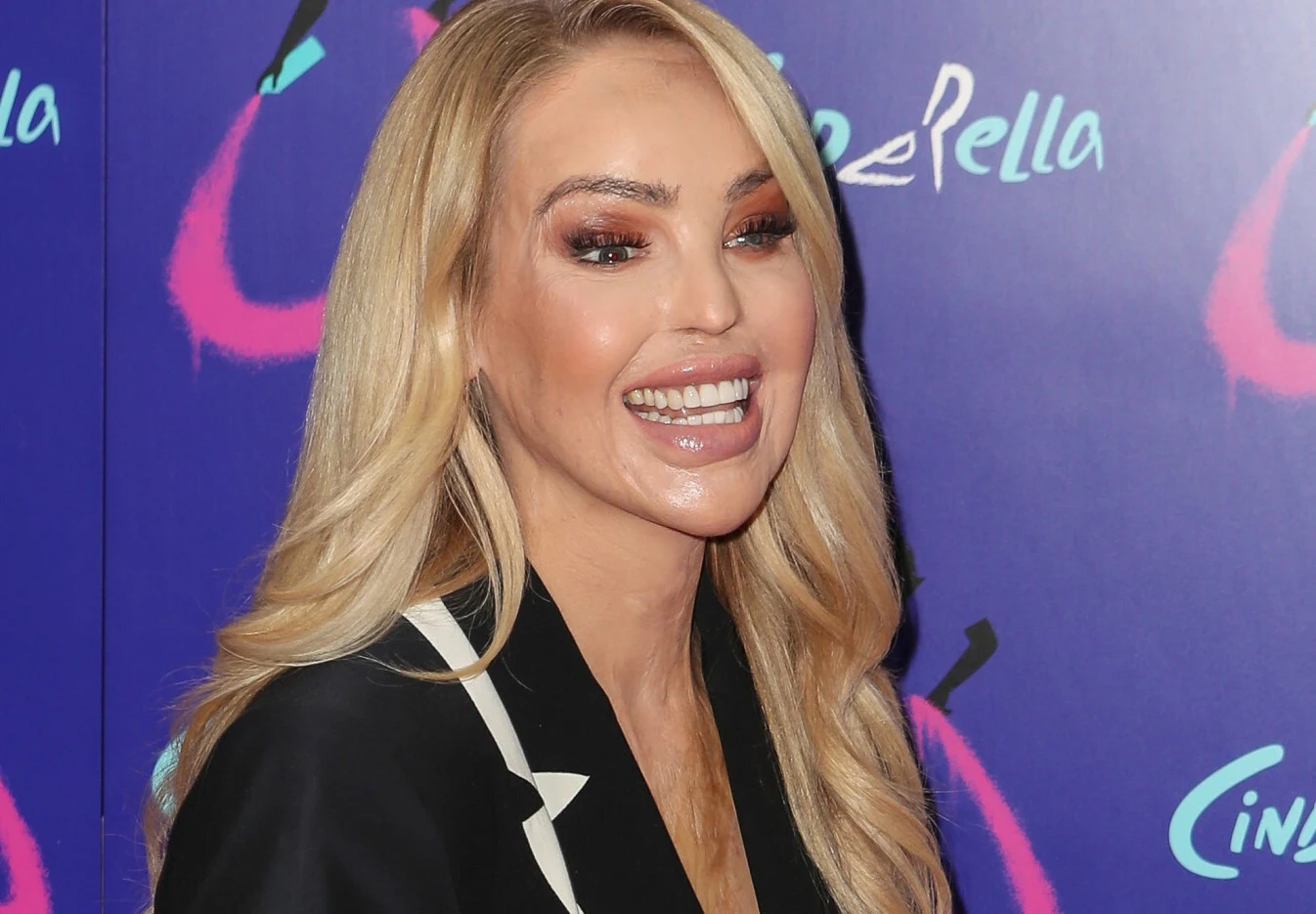 Katie Piper Katie Piper