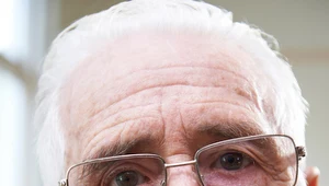 Opadający kącik ust to nie drobnostka. To poważny sygnał alarmowy