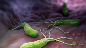 Helicobacter Pylori - niechciany lokator